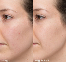 Load image into Gallery viewer, FarmHouse Fresh Comeback Clear Acne Banishing Kit